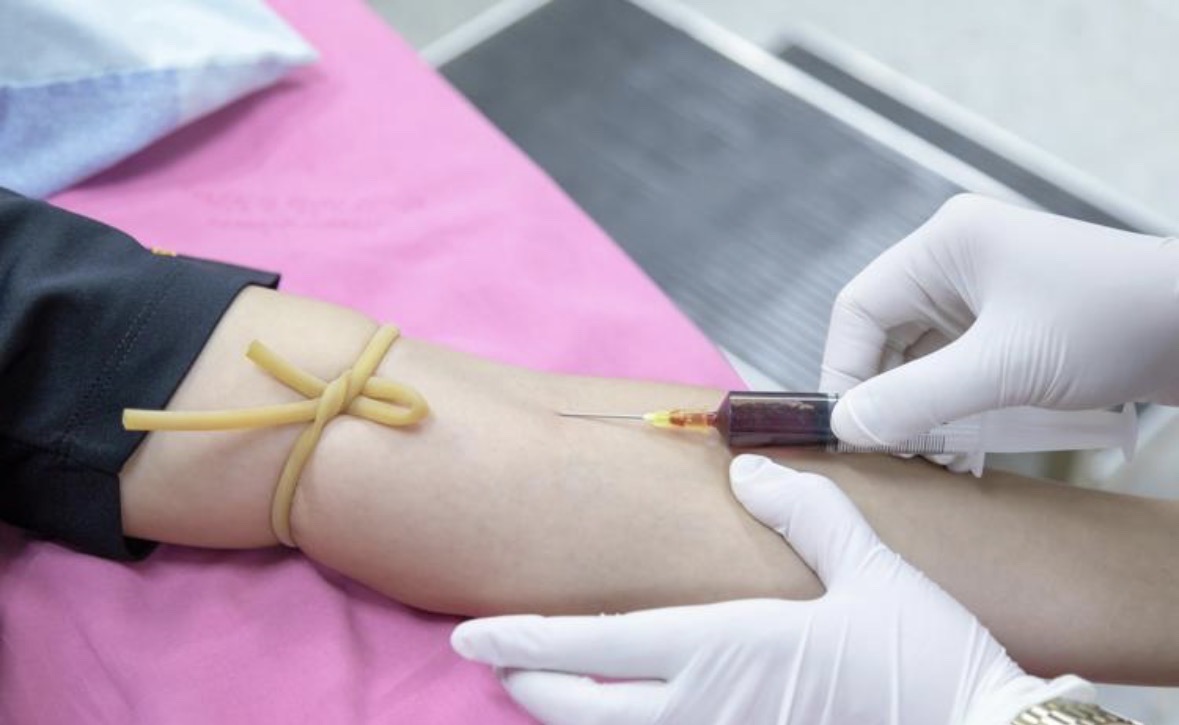 Why fasting requirements differ by blood draw purpose