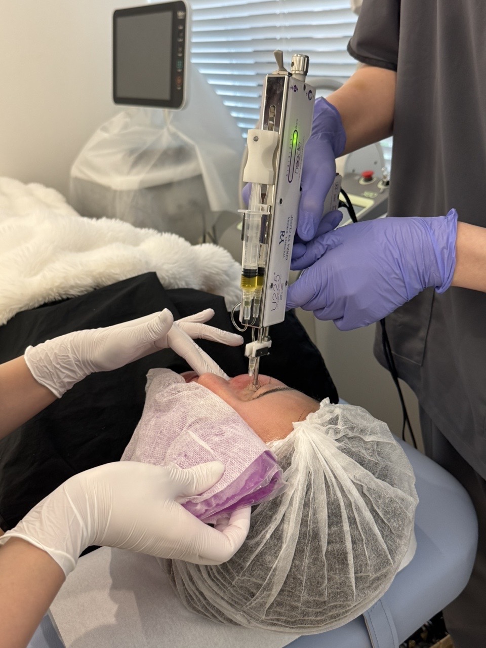 Woman in her 30s from Canada | NAD/NMN, vitamin C and facial PRP