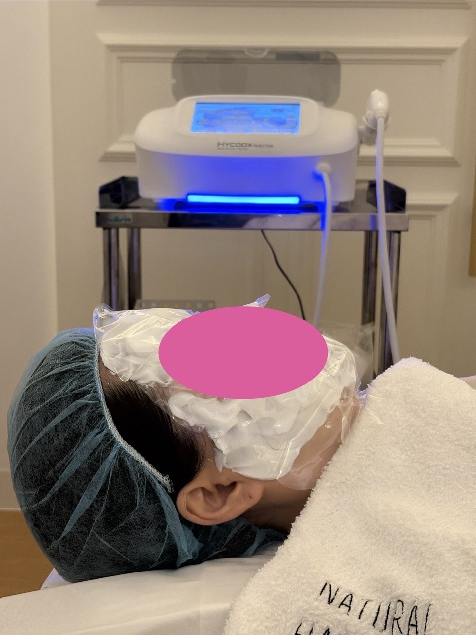 Autologous fibroblast injection | second session