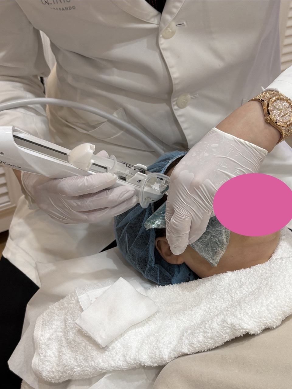 Autologous fibroblast injection: second-session patient journey