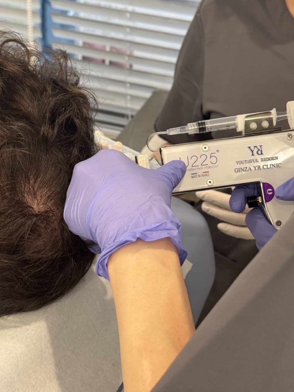Male scalp care | one-month follow-up
